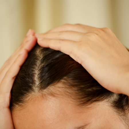 Hairline